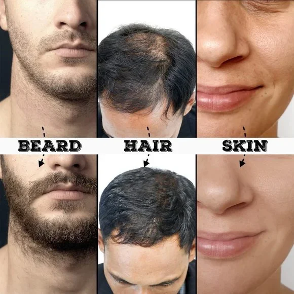 New Derma Roller for Beard Hair Skin Face 540 Titanium .25mm​ - Picture 4 of 6